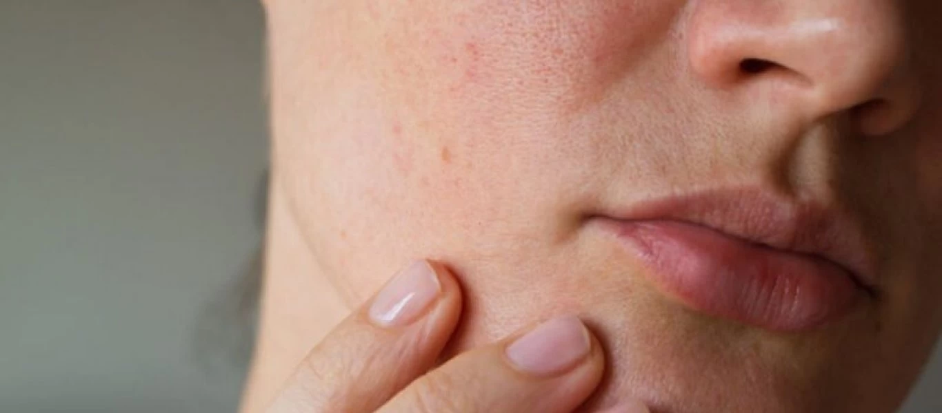 8 μέθοδοι που υπάρχουν για κάθε σύμπτωμα